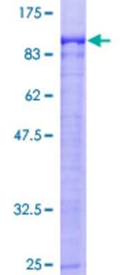 12.5% SDS-PAGE Stained with Coomassie Blue.