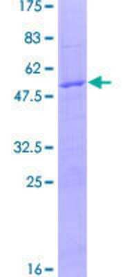 12.5% SDS-PAGE Stained with Coomassie Blue.