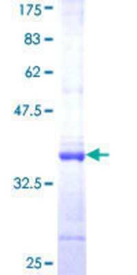 SDS-Page: Recombinant Human USP52 Protein [H00009924-Q01] - 12.5% SDS-PAGE Stained with Coomassie Blue.