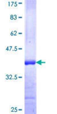 12.5% SDS-PAGE Stained with Coomassie Blue.