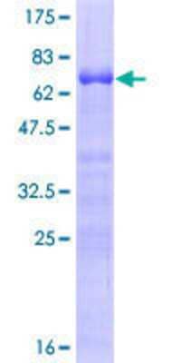 12.5% SDS-PAGE Stained with Coomassie Blue.