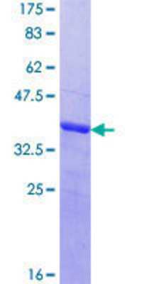 12.5% SDS-PAGE Stained with Coomassie Blue.