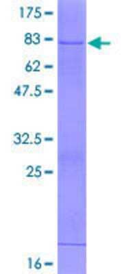 12.5% SDS-PAGE Stained with Coomassie Blue.
