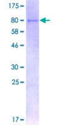 12.5% SDS-PAGE Stained with Coomassie Blue.