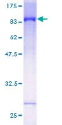 Other Recombinant Human Rev-erb beta/NR1D2 GST (N-Term) Protein