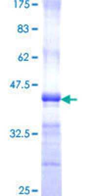 SDS-Page: Recombinant Human PPP4R1 Protein [H00009989-Q01] - 12.5% SDS-PAGE Stained with Coomassie Blue.