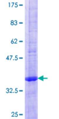 12.5% SDS-PAGE Stained with Coomassie Blue.