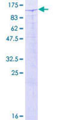 SDS-Page: Recombinant Human Kaiso Protein [H00010009-P01] - 12.5% SDS-PAGE Stained with Coomassie Blue.