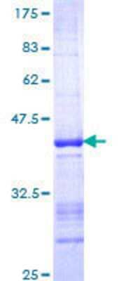 12.5% SDS-PAGE Stained with Coomassie Blue.