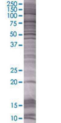 BCL2L10 transfected lysate.