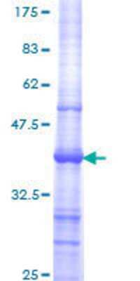 SDS-Page: Recombinant Human MED16 Protein [H00010025-Q01] - 12.5% SDS-PAGE Stained with Coomassie Blue.