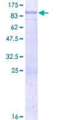 12.5% SDS-PAGE Stained with Coomassie Blue.