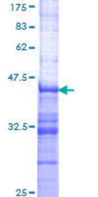12.5% SDS-PAGE Stained with Coomassie Blue.