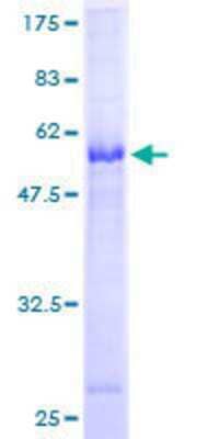 SDS-PAGE Recombinant Human CTDSP2 GST (N-Term) Protein