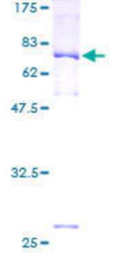 12.5% SDS-PAGE Stained with Coomassie Blue.