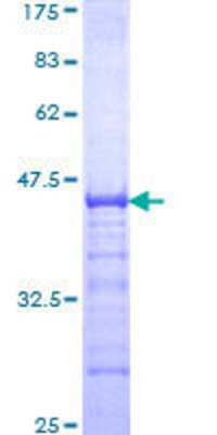 SDS-Page: Recombinant Human ZNF263 Protein [H00010127-Q01] - 12.5% SDS-PAGE Stained with Coomassie Blue.