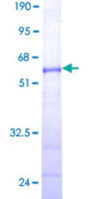 12.5% SDS-PAGE Stained with Coomassie Blue.