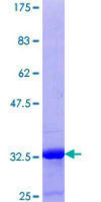12.5% SDS-PAGE Stained with Coomassie Blue.