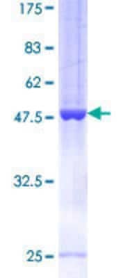 SDS-Page: Recombinant Human ARFRP1 Protein [H00010139-P01] - 12.5% SDS-PAGE Stained with Coomassie Blue.