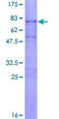 12.5% SDS-PAGE Stained with Coomassie Blue.