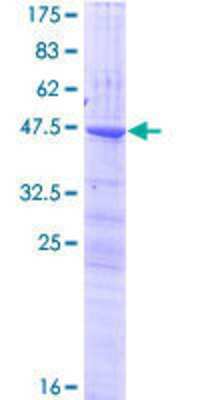 12.5% SDS-PAGE Stained with Coomassie Blue.