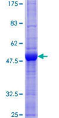 SDS-Page: Recombinant Human IL-27/IL-35 EBI3 Subunit Protein [H00010148-P01] - 12.5% SDS-PAGE Stained with Coomassie Blue.