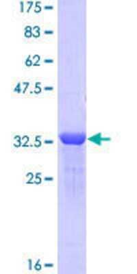 12.5% SDS-PAGE Stained with Coomassie Blue.