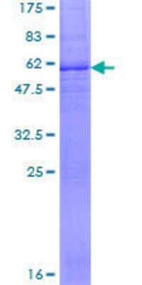 12.5% SDS-PAGE Stained with Coomassie Blue.