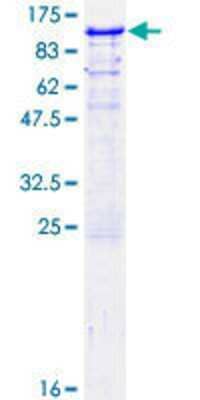 12.5% SDS-PAGE Stained with Coomassie Blue.