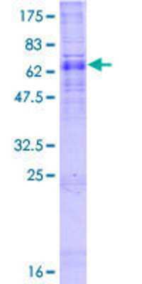 12.5% SDS-PAGE Stained with Coomassie Blue.