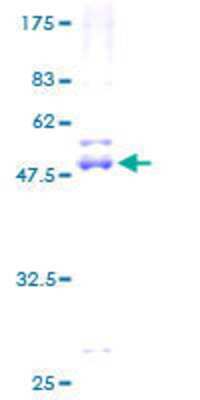 12.5% SDS-PAGE Stained with Coomassie Blue.