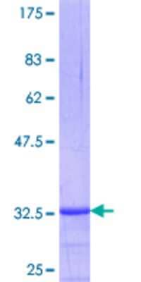 12.5% SDS-PAGE Stained with Coomassie Blue.