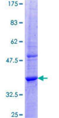 12.5% SDS-PAGE Stained with Coomassie Blue.