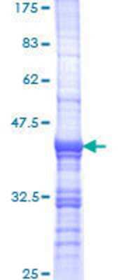 12.5% SDS-PAGE Stained with Coomassie Blue.