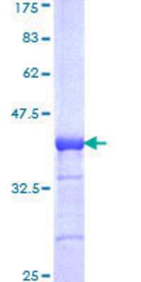 SDS-Page: Recombinant Human TOPORS Protein [H00010210-Q01] - 12.5% SDS-PAGE Stained with Coomassie Blue.