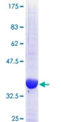 12.5% SDS-PAGE Stained with Coomassie Blue.