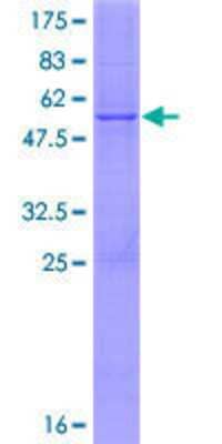 12.5% SDS-PAGE Stained with Coomassie Blue.