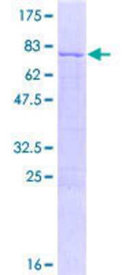 12.5% SDS-PAGE Stained with Coomassie Blue.