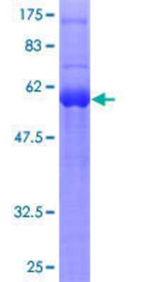 Other Recombinant Human SPRY1 GST (N-Term) Protein