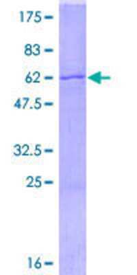 SDS-Page: Recombinant Human SPRY2 Protein [H00010253-P01] - 12.5% SDS-PAGE Stained with Coomassie Blue.