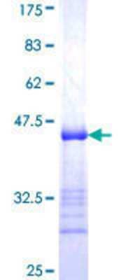 SDS-Page: Recombinant Human STAM2 Protein [H00010254-Q01] - 12.5% SDS-PAGE Stained with Coomassie Blue.