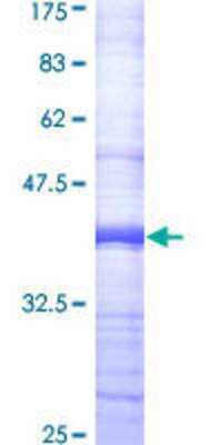 12.5% SDS-PAGE Stained with Coomassie Blue.