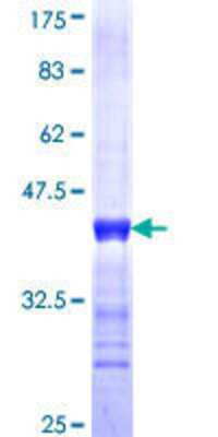 C-myc promoter-binding protein Partial Recombinant Protein[H00010260-Q01]- 12.5% SDS-PAGE Stained with Coomassie Blue. 