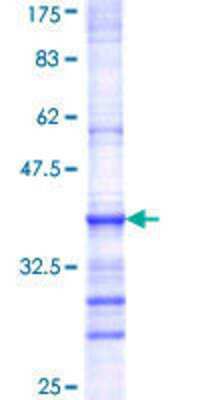 12.5% SDS-PAGE Stained with Coomassie Blue.