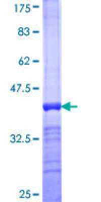 SDS-Page: Recombinant Human SF3A1 Protein [H00010291-Q01] - 12.5% SDS-PAGE Stained with Coomassie Blue.