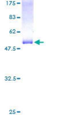 12.5% SDS-PAGE Stained with Coomassie Blue.