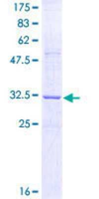 SDS-Page: Recombinant Human RTN3 Protein [H00010313-Q01] - 12.5% SDS-PAGE Stained with Coomassie Blue.