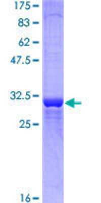 12.5% SDS-PAGE Stained with Coomassie Blue.
