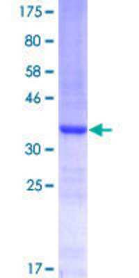 SDS-Page: Recombinant Human CBARA1 Protein [H00010367-Q01] - 12.5% SDS-PAGE Stained with Coomassie Blue.
