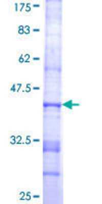 SDS-Page: Recombinant Human ST3GAL6 Protein [H00010402-Q01] - 12.5% SDS-PAGE Stained with Coomassie Blue.